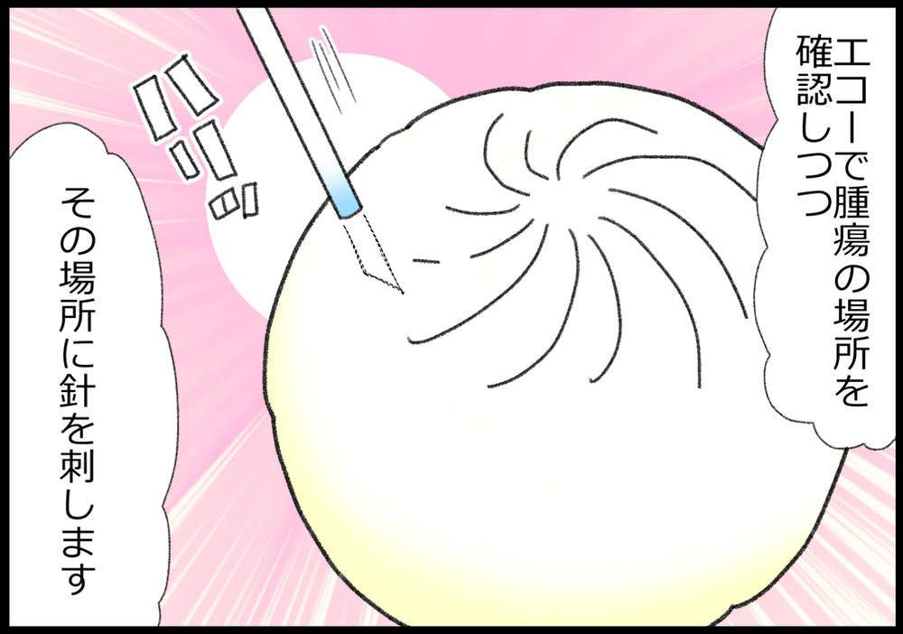 音が大きくて怖い!? 乳がん検診で指摘されたしこりの生検を実際に受けると…【ヲタママだっていーじゃない！ 第153話】