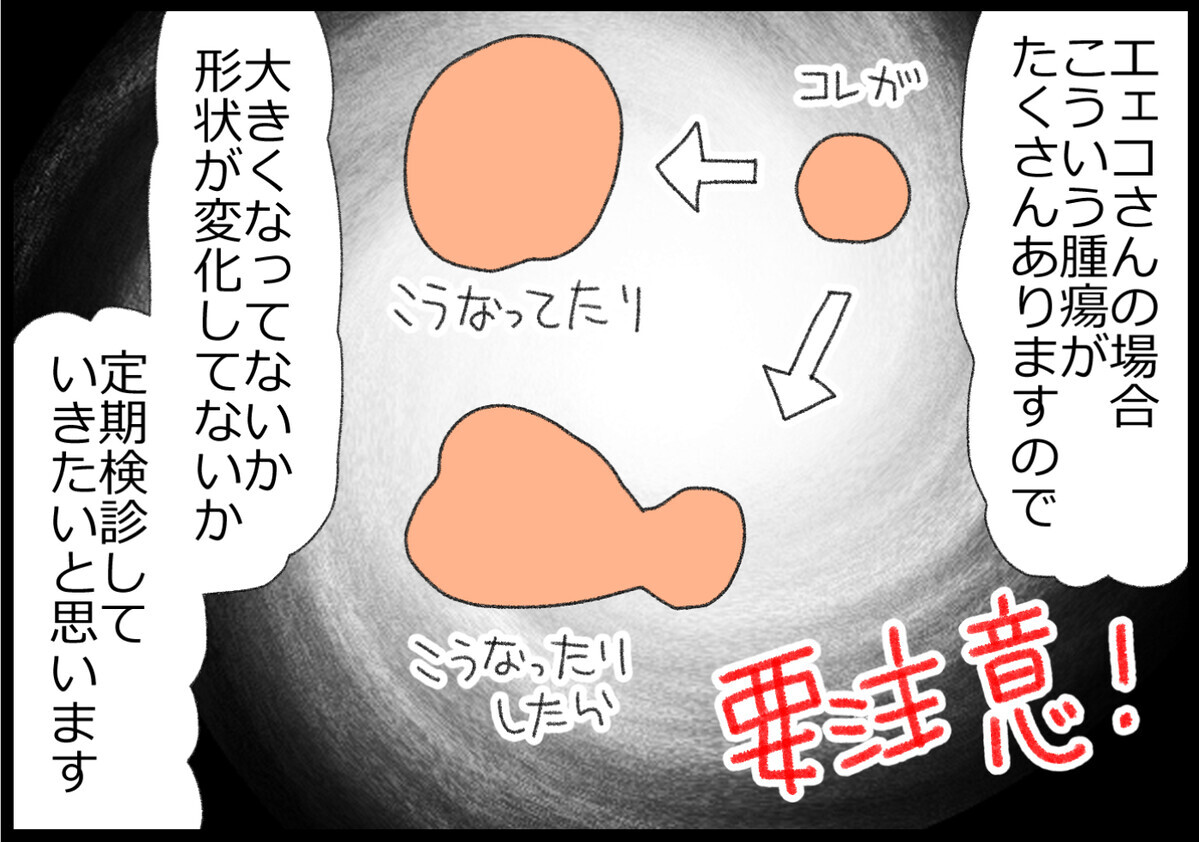 私の場合は、この腫瘍がたくさんあるので、定期健診で変化していないか確認していくと言われました。