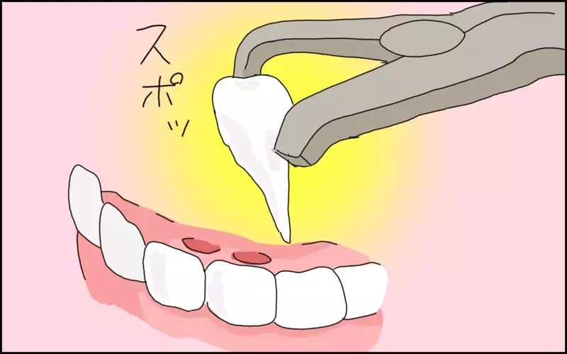 乳歯が抜ける前に永久歯が生えてきた息子…ハードな施術のあとに涙したのは…!?【たんこんちは　ボロボロゆかい Vol.35】