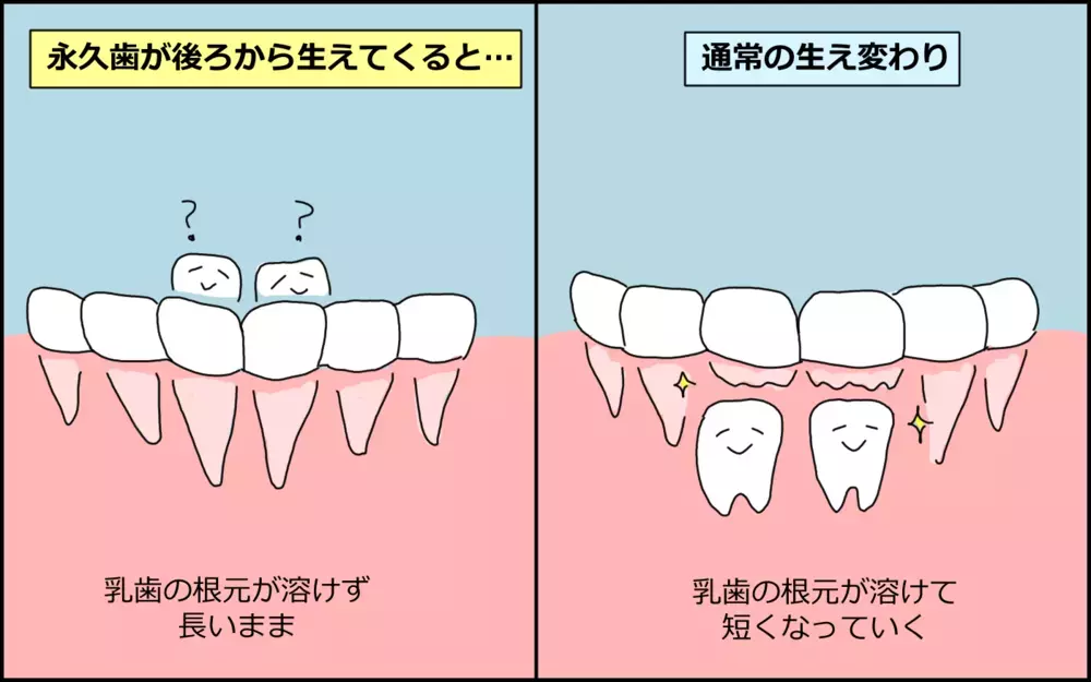 乳歯が抜ける前に永久歯が生えてきた息子…ハードな施術のあとに涙したのは…!?【たんこんちは　ボロボロゆかい Vol.35】