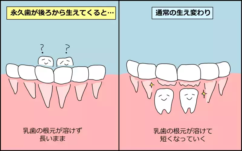 乳歯が抜ける前に永久歯が生えてきた息子…ハードな施術のあとに涙したのは…!?【たんこんちは　ボロボロゆかい Vol.35】