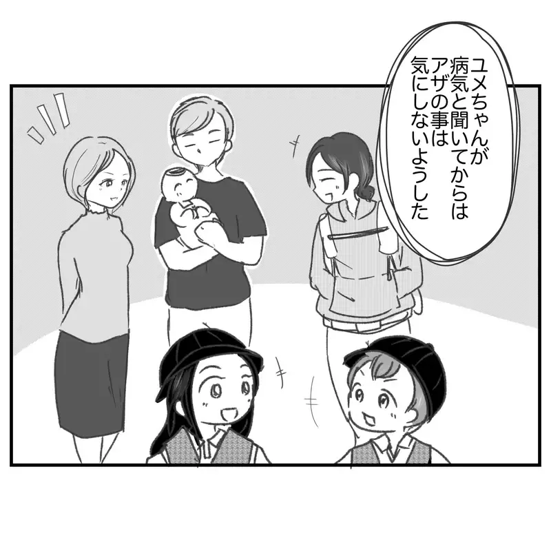 アザが病気なら仕方がない…しかし夫はある言動が引っかかっていた!?【違和感のある家族 Vol.14】