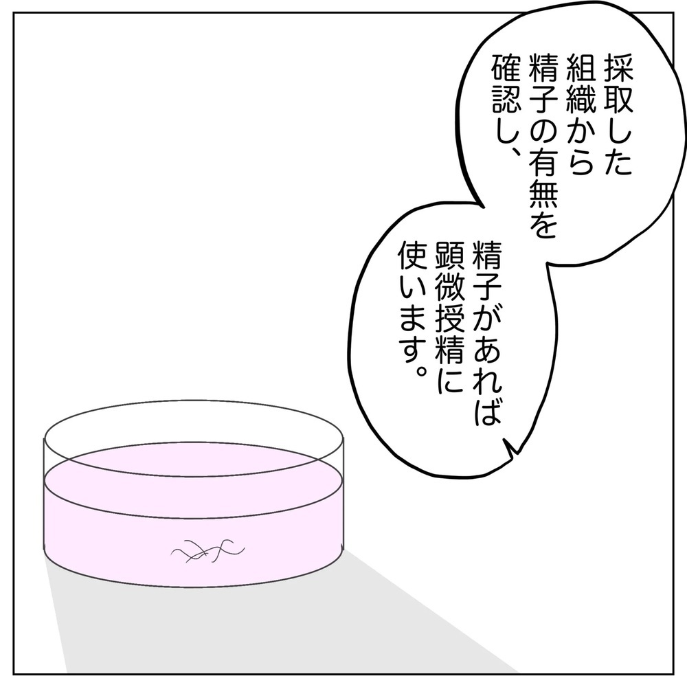 ショックで言葉が出ない夫… 男性不妊でも治療法はある？【原因は俺…？ Vol.7】
