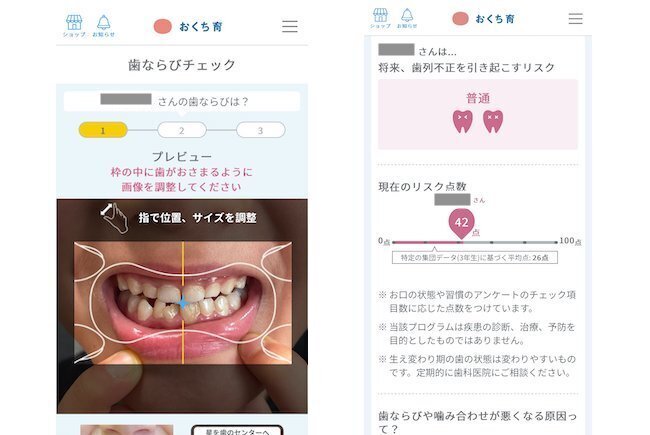 子どもの歯並びが気になる… 噛む力を鍛える「噛もっと！」グミ＆ガムを試してみました！【編集部がリアルに体験！ Vol.8】