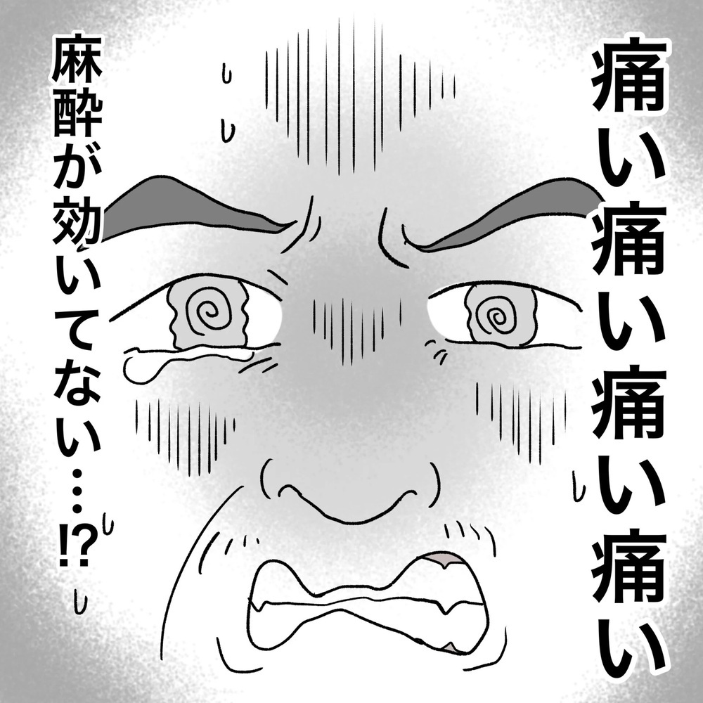 ついに手術がスタート　まさかこれ…麻酔が効いてない!?【原因は俺…？ Vol.14】