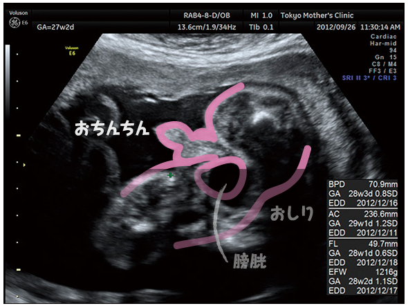 妊娠7ヶ月のエコー 超音波 写真 16年4月4日 ウーマンエキサイト