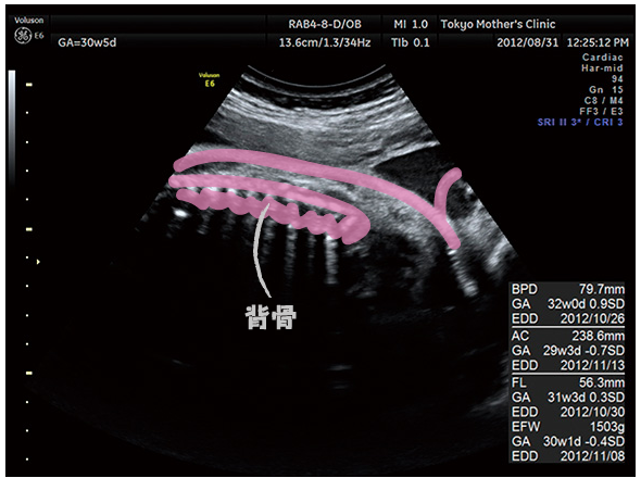 妊娠8ヶ月のエコー 超音波 写真 16年4月4日 ウーマンエキサイト