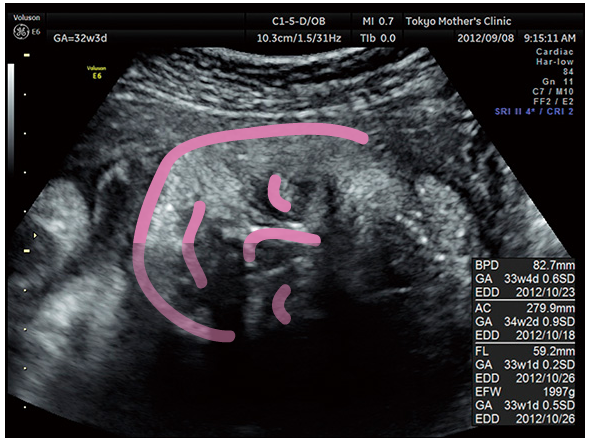 妊娠9ヶ月のエコー 超音波 写真 16年4月4日 ウーマンエキサイト