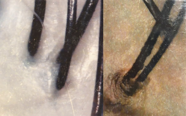 女性の薄毛には酸化が大敵!? 健康的でツヤツヤな毛髪をキープする秘訣