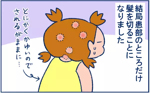 とびひを甘く見ていた…！ 体中にとびまくり、最後は丸坊主の危機に!?【双子育児まめまめ日記 第9話】