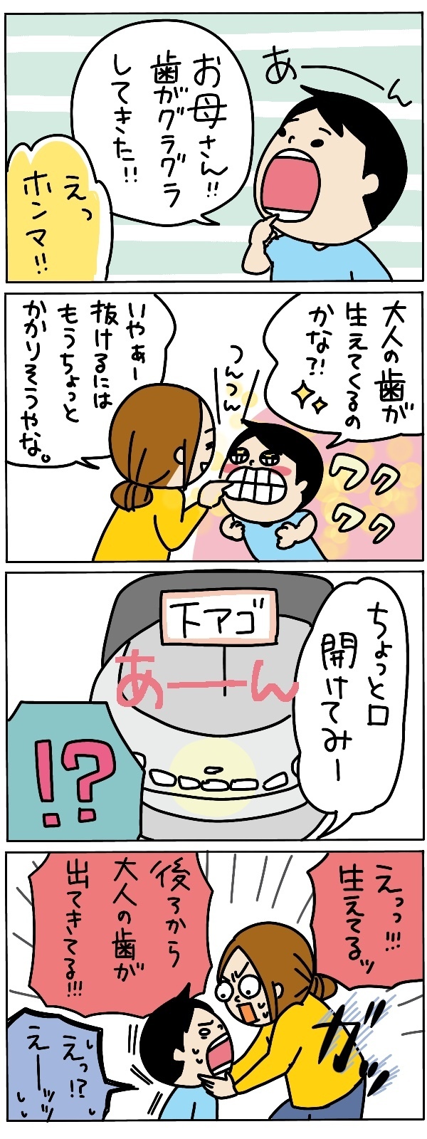 大人の歯が生えてきたと思ったら…あれ？　長男の初めての永久歯は二枚歯でした【うちのアホかわ男子たち 第64話】