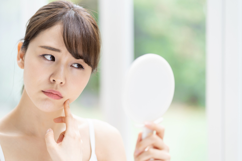 【医師監修】黄ニキビはつぶす？　放置する？　正しい対処方法を知ろう