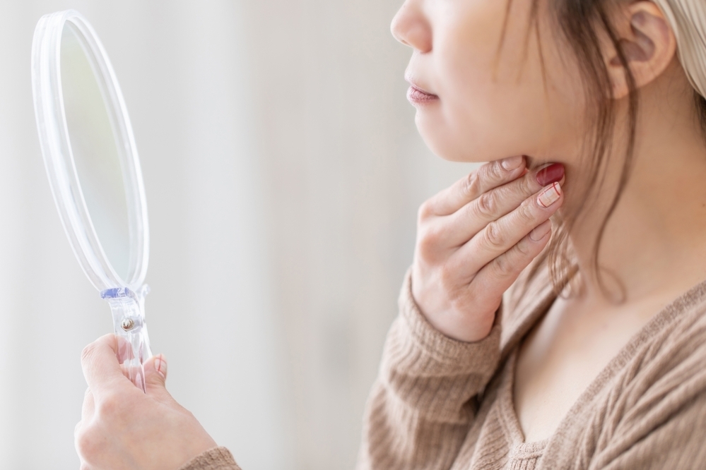 【医師監修】あごニキビの原因は？　Uゾーンのニキビケア方法とは