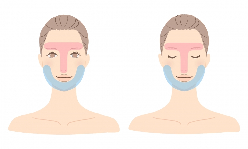 【医師監修】あごニキビの原因は？　Uゾーンのニキビケア方法とは