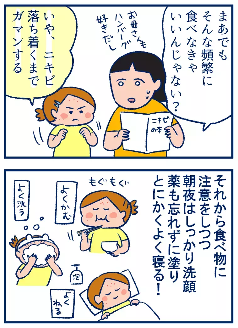 小学生のニキビ対策で大事なこととは？　娘の生活ぶりを見て学んだこと【双子を授かっちゃいましたヨ☆ 第243話】