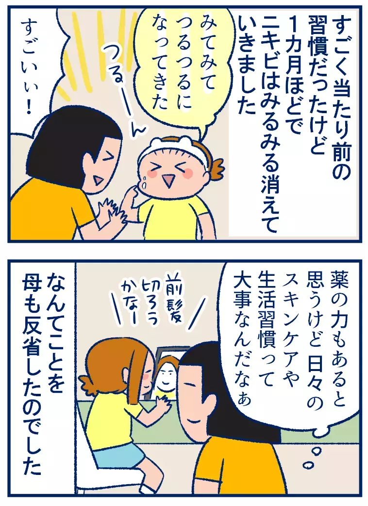 小学生のニキビ対策で大事なこととは？　娘の生活ぶりを見て学んだこと【双子を授かっちゃいましたヨ☆ 第243話】