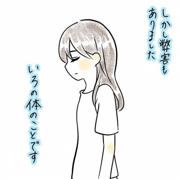 体質と向き合い自分なりの生活を確立している私。でも、当時の彼は少し“否定的”で…＜病んでマッチングアプリ始めたら勘違い野郎と付き合った話＃1＞