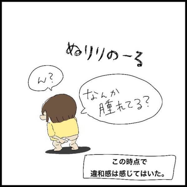 ＜アラサー女子が痔で入院した話＞「なんか腫れてる…？」旅行前に“お尻に違和感”を感じた私。これが“とんでもない事態”を引き起こすことになるなんて…！？【＃4】