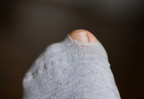 穴があいた『靴下』捨てるのちょっと待った！長く使うための方法