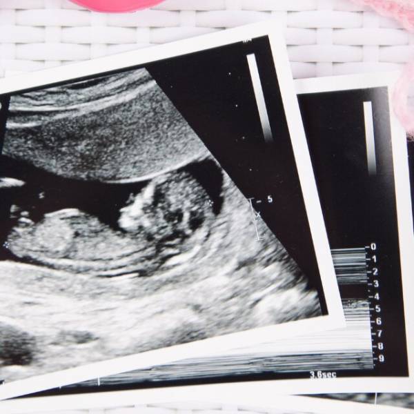 妻の妊娠が判明！しかし「本当に俺の子？」懐疑的な夫に違和感…2週間後⇒妻「じゃあDNA鑑定するね」夫「やっぱしなくていい」