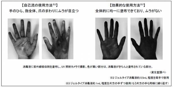 【手指の消毒方法】「ローションタイプ」と「ジェルタイプ」は使用法が違う… 正しい“消毒のコツ”をご紹介！
