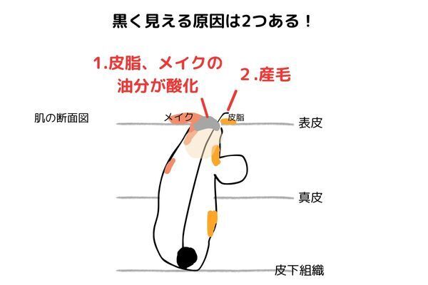 実は毛穴の黒ずみじゃないかも… エステティシャン直伝「セルフでできるフェイスケア」