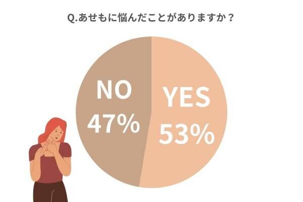 やめたら手荒れ改善しました！【女性約100人調査】夏に起こる「あせも・しっしん予防策」