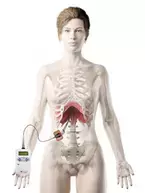 新たな呼吸管理方法「横隔膜ペースメーカー」をオンライン勉強会で紹介