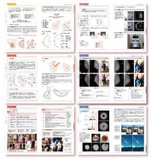 技師・医師のためのマンモグラフィ撮影技術のテキスト『Mammography Positioning Text』完成！発売開始！
