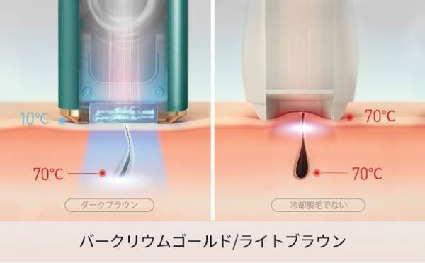 自宅でコスパ良く気軽に脱毛できる「ULIKE AIR＋脱毛器」アマゾンセール開催