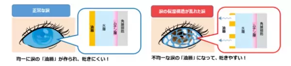 ドライアイ(目の乾き)の要因として、涙の蒸発に着目　蒸発を防ぐベールとしてはたらく涙の「油層」を、安定化させる成分を発見！
