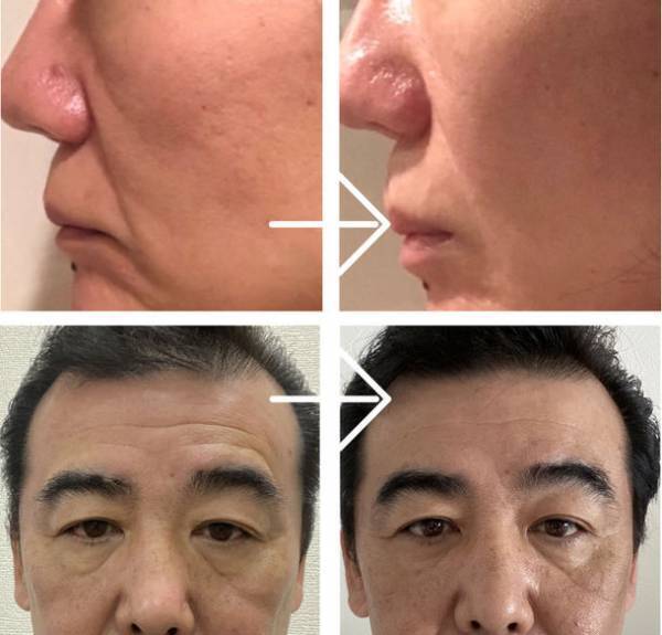 スキンケアの常識を覆す電気・電池を使用しない美顔器マスク　体内電流をエネルギーとした“G-ZERO COIL FACIAL MASK”がMakuakeにて公開1週間で応援購入650万円を達成！