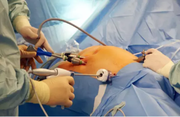 金沢大学共同開発。内視鏡下手術の手ブレ矯正トレーニング機器「LapaSta Z(ラパスタ ゼット)」誕生。2021年12月24日より販売開始