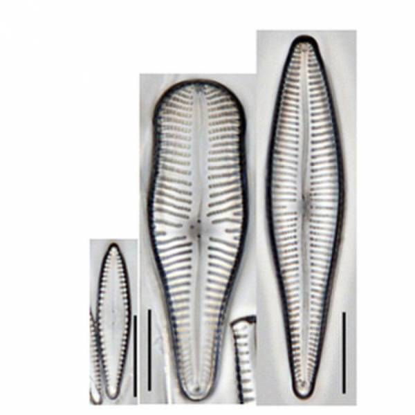 ＜世界初＞人気のメダカ水槽に発生するコケの正体を調査・発表