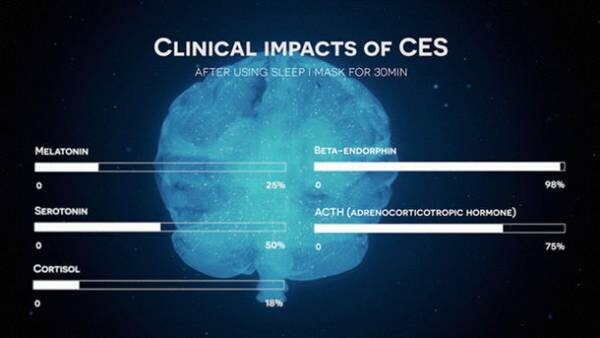 メラトニン分泌のサポートで睡眠のお悩みを解決！独自開発のCESテクノロジーを使用した最新快眠ウェアラブルデバイス『Sleepisol』の先行販売を開始