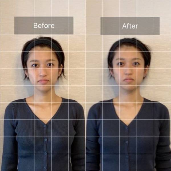 広島市中区にある“ドライヘッドスパ専門店Totonou”　メニューに、痛くない「小顔リフトアップ整顔」が1月より導入！