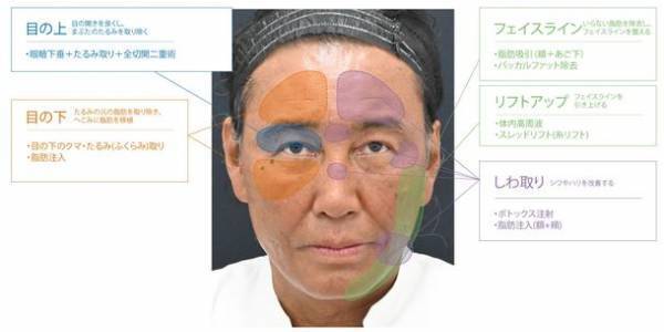 たいめいけん茂出木シェフが総額300万円超の若返り整形！SBC湘南美容クリニック秋葉原院の名倉 俊輔医師が執刀