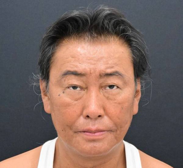 たいめいけん茂出木シェフが総額300万円超の若返り整形！SBC湘南美容クリニック秋葉原院の名倉 俊輔医師が執刀