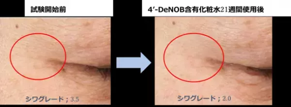 シトラス果皮発酵エキス「4'-デメチルノビレチン」が角層セラミド量を増加させ、シワを改善させることを富士産業が発見