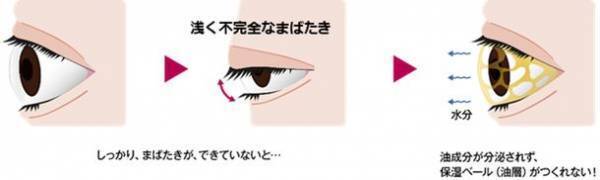 現代人の“まばたき”は浅くて半開きになりがち！？ドライアイの原因となる“まばたき不全”に注意！眼科医が解説・まばたき不全と涙の蒸発を防ぐ“瞳の保湿ベール”とは