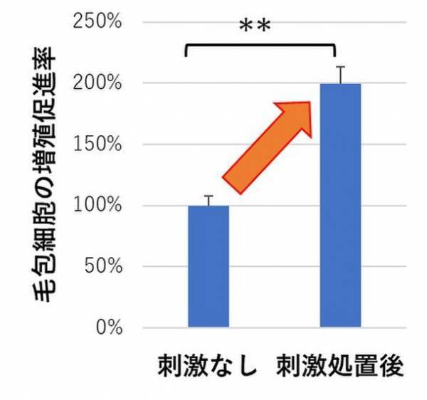 富士産業、毛組織細胞への刺激により分泌される新たな育毛タンパクを発見　～新たな育毛アプローチによる脱毛症に対する効果へ期待～