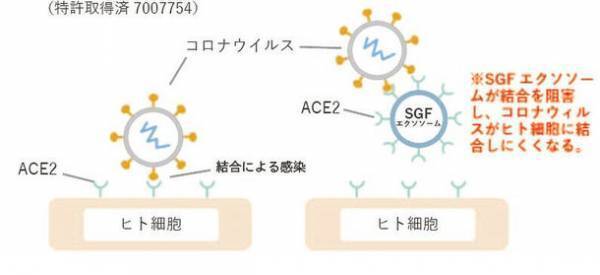 SGFによる新型コロナウイルスの感染予防キットの提供を開始