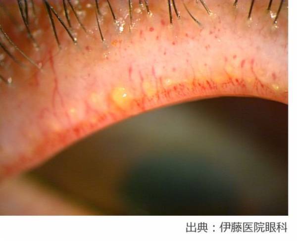 意外と知らない！？毎日のアイメイクで気をつけたいポイント　瞳を大きく見せるメイク、実はドライアイを深刻化させている可能性　目に優しいアイメイクとケア方法を“瞳の保湿ベール”を乱す原因と共に解説