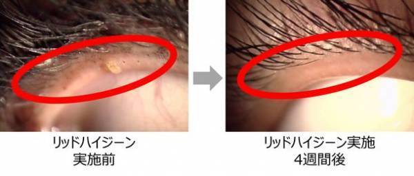 意外と知らない！？毎日のアイメイクで気をつけたいポイント　瞳を大きく見せるメイク、実はドライアイを深刻化させている可能性　目に優しいアイメイクとケア方法を“瞳の保湿ベール”を乱す原因と共に解説