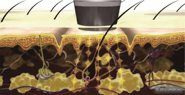 エステサロンオーナーも知らないエレクトロポレーション導入理論を解説　ユニッシュ、オンラインセミナー「正しいポレーション機器の選び方」を開催！