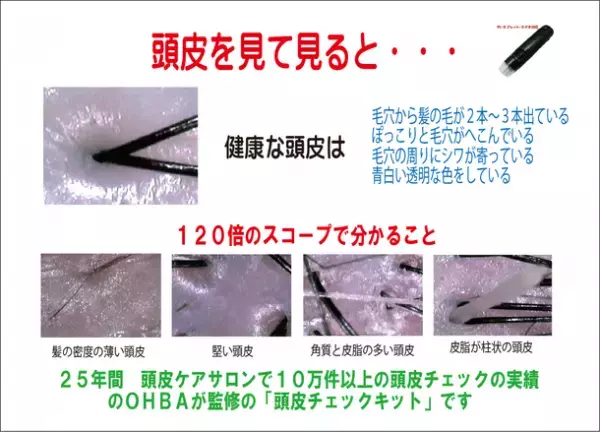 国内初！【抜け毛・薄毛・頭皮のトラブル】についてお悩みの方へ！オンラインで申し込める「頭皮のチェックキット」システム誕生！