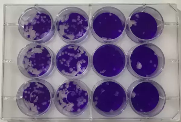 医学的に正しく、社会貢献が大きく期待される製品として、奈良県立医科大学・MBTコンソーシアムからロゴマークの使用が許諾。＜歯科クリニックにおける活用事例の紹介＞「ZENON 特殊アルカリ電解水／SDGs レポート(2)」を公開