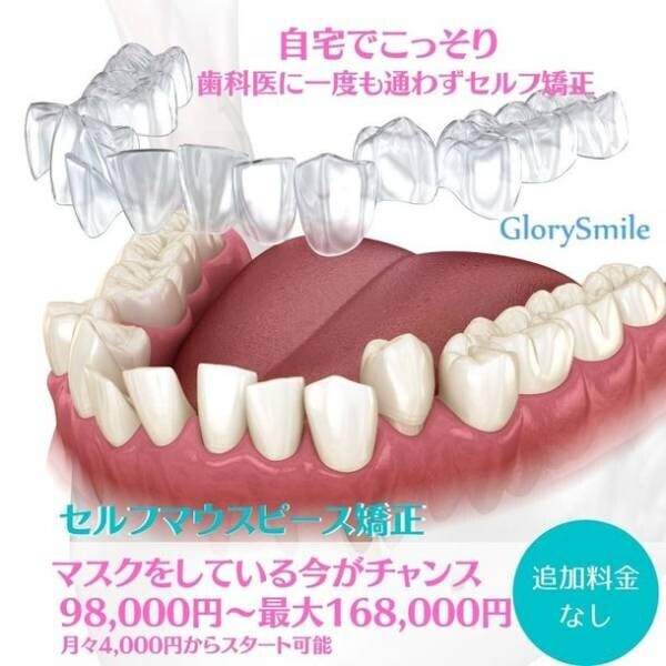歯科医院に一度も行かずに歯の矯正が安価でできる　セルフマウスピース矯正「GlorySmile」を3月1日より提供開始