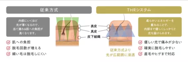 自宅でサロンクオリティの脱毛！業界最高峰の照射パワーを発揮する家庭用光美容器『OPUS BEAUTY03 Power Pro』予約販売開始