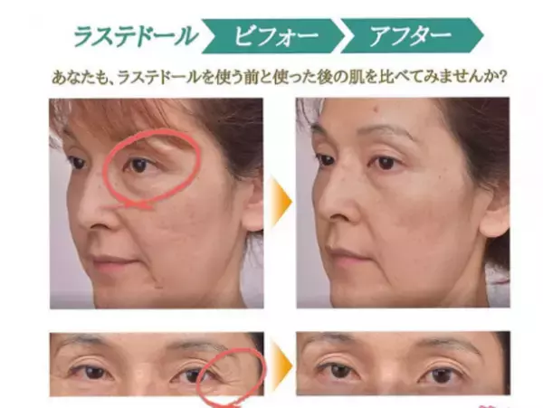 美容成分をたっぷり配合したアイ用(目元)パック「LUSTED'OR-ラステドール」が≪ヨドバシ.com≫で販売開始！サロン専売品、特許技術を活用